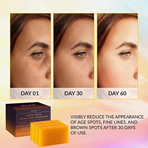 VALITIC Kojic Acid Dark Spot Remover Soap Bars with Vitamin C, Retinol, Collagen, Turmeric - Original Japanese Complex Infused with Hyaluronic Acid, Vitamin E, Shea Butter, Castile Olive Oil (2 Pack) - VINE GLOBAL
