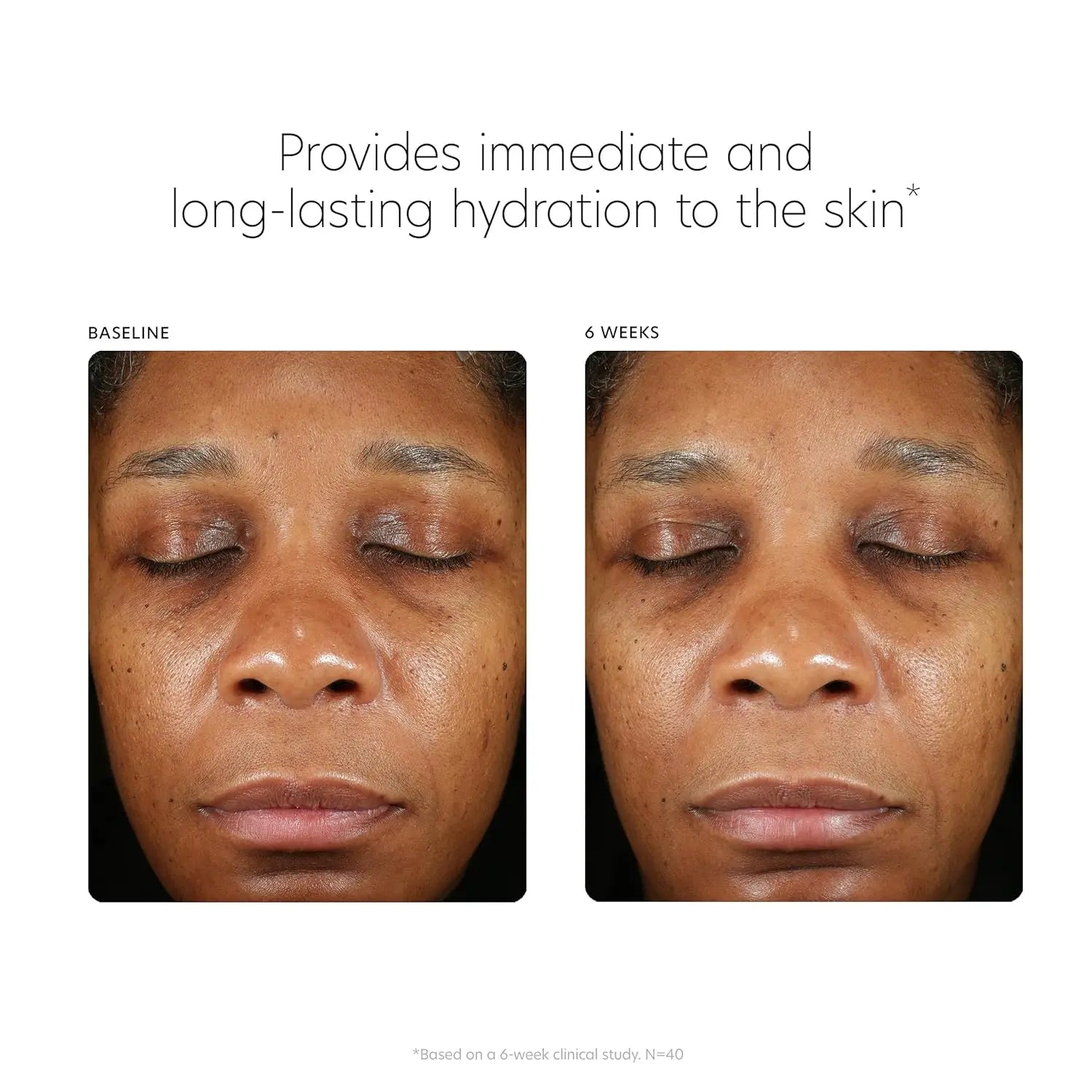 PCA SKIN Hyaluronic Acid Boosting Face Serum, Hyaluronic Acid Serum for Face Made with Niacinamide and Ceramides, Helps Reduce Fine Lines and Wrinkles and Delivers 24-Hour Moisturization, 1 oz Pump VINE GLOBAL