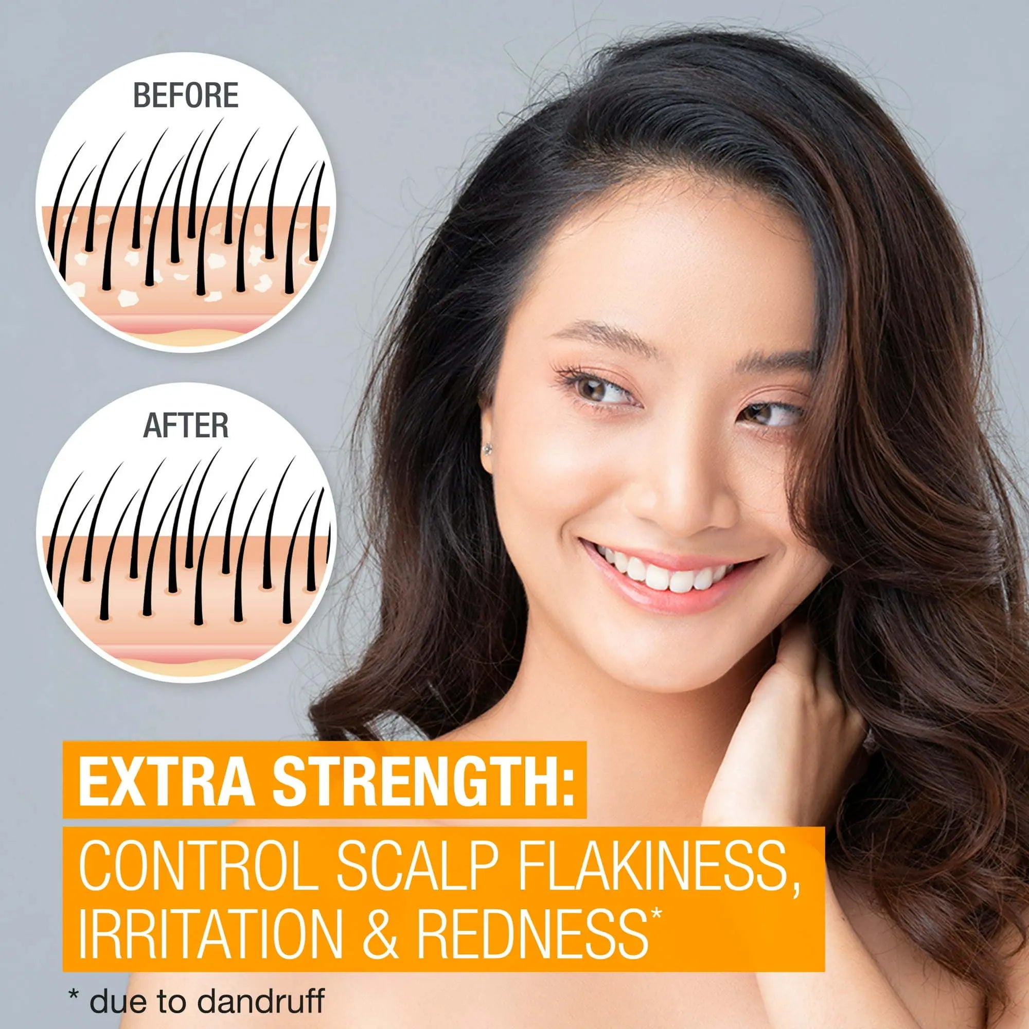 Neutrogena Scalp Therapy Anti-Dandruff Extra Strength - VINE GLOBAL