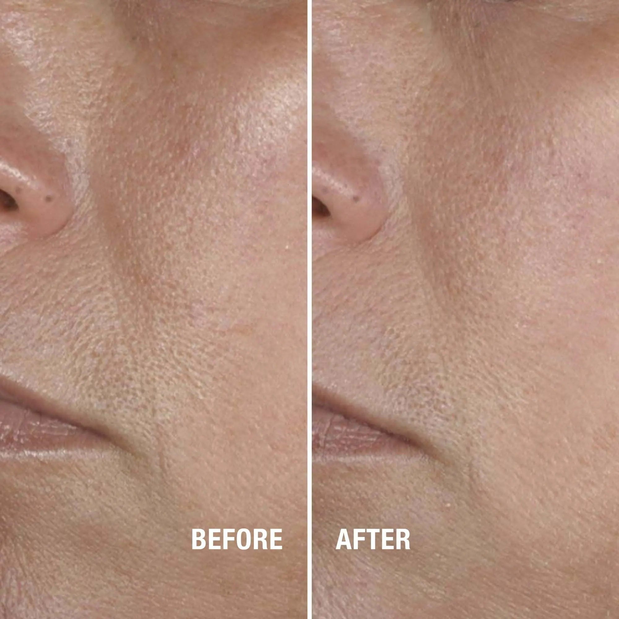 Neutrogena Skin Balancing Milky Cleanser; 2% Polyhydroxy Acid, 6.3 oz - VINE GLOBAL